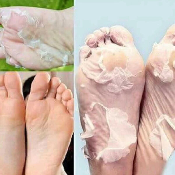 KIT ÉCLAIRCISSANT POUR MAINS ET PIEDS – Image 3