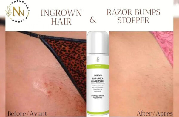 LOTION ANTI-POILS INCARNES - NATURELLE NUBIAN – Image 3