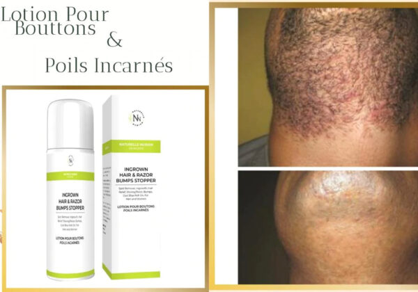 LOTION ANTI-POILS INCARNES - NATURELLE NUBIAN – Image 4